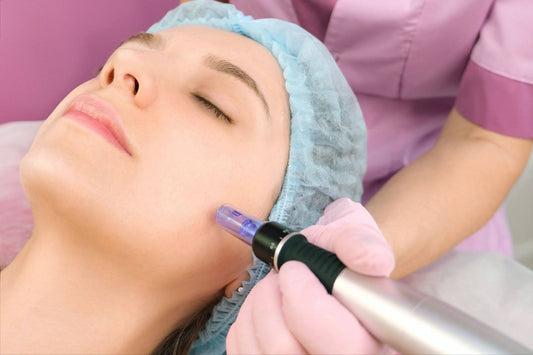 microneedling