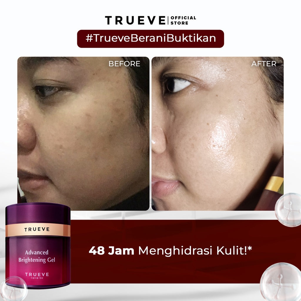 TRUEVE Advanced Brightening Gel | 15 gr