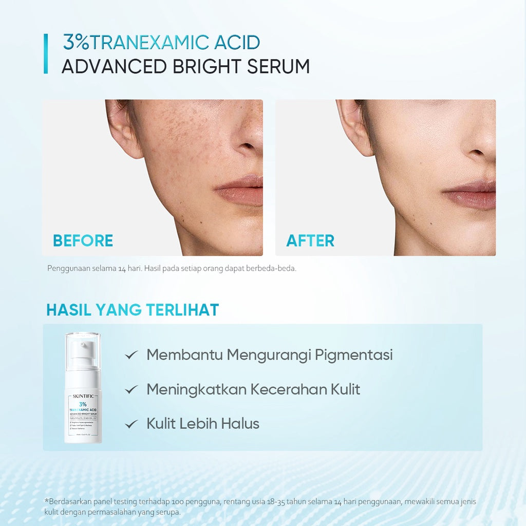 Skintific 3% Tranexamic Acid Advanced Bright Serum