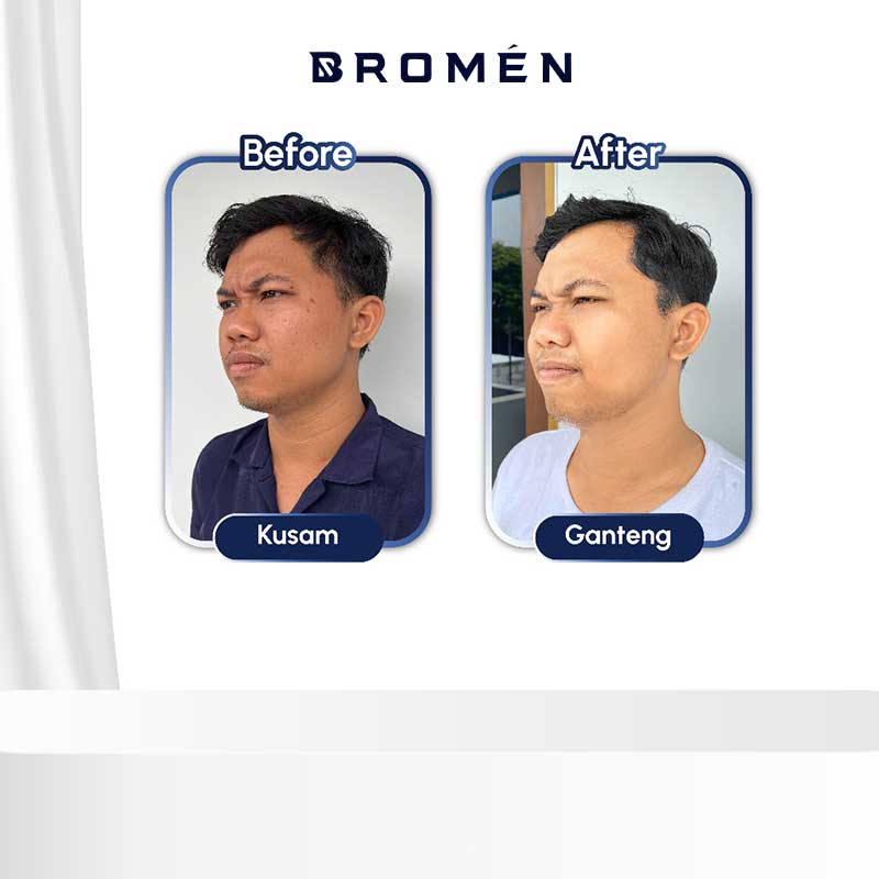 BROMEN Brightening Soap 50gr