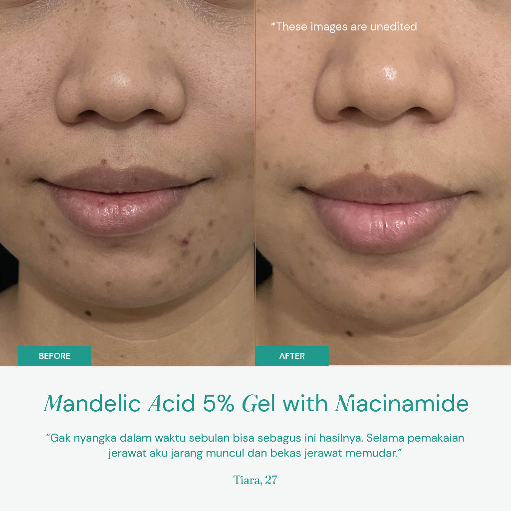 FSS by For Skin's Sake Mandelic Acid Gel 5% with Niacinamide