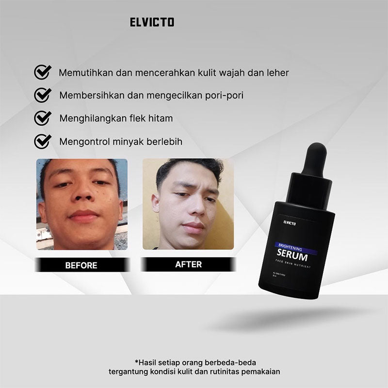 Elvicto Brightening Serum | 30 ml