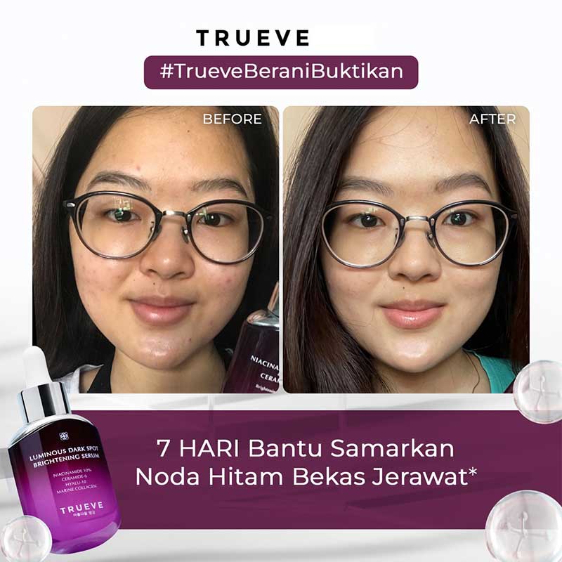 TRUEVE Luminous Dark Spot Brightening Serum | 15 ml