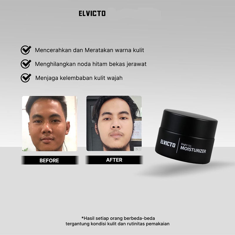 Elvicto Bright Up Moisturizer | 15 ml