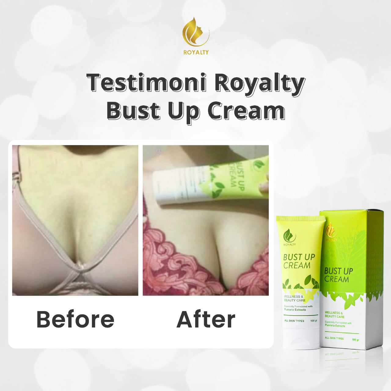 Glowpedia Royalty Bust Up Cream (Krim Pengencang Payudara) | 100 g