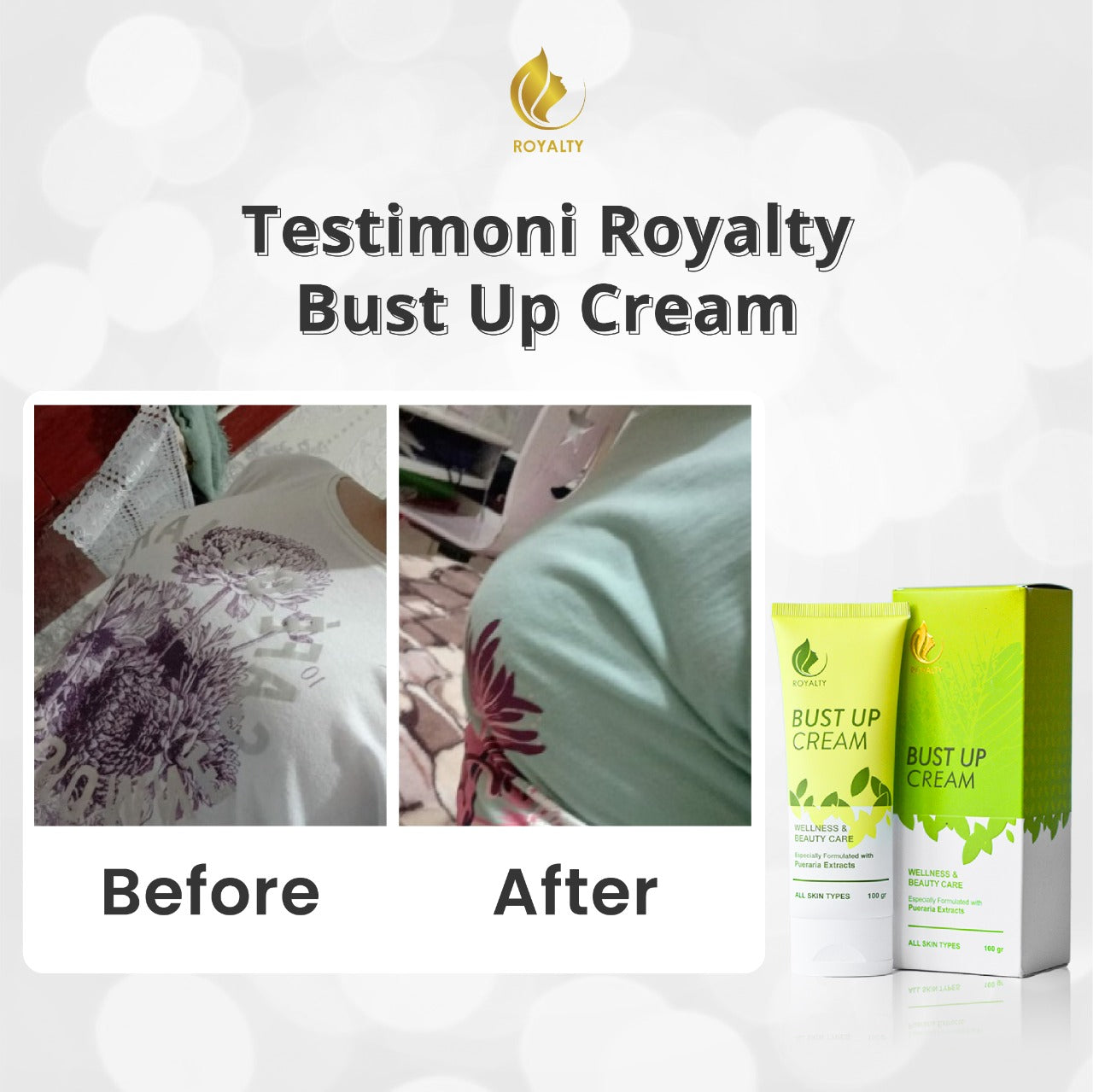 Glowpedia Royalty Bust Up Cream (Krim Pengencang Payudara) | 100 g