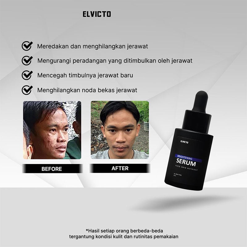 Elvicto Brightening Serum | 30 ml