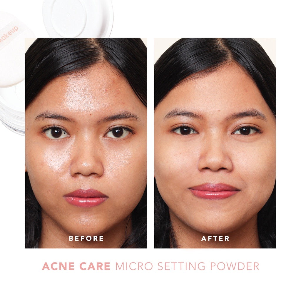 Sea Makeup Acne Care Micro Setting Powder | 12 g