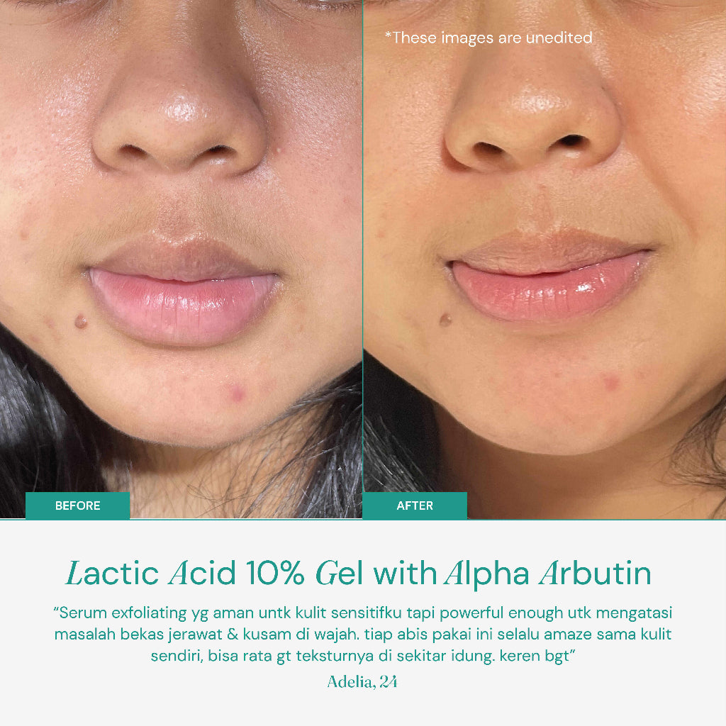 FSS by For Skin's Sake Lactic Acid Gel 10% with Alpha Arbutin