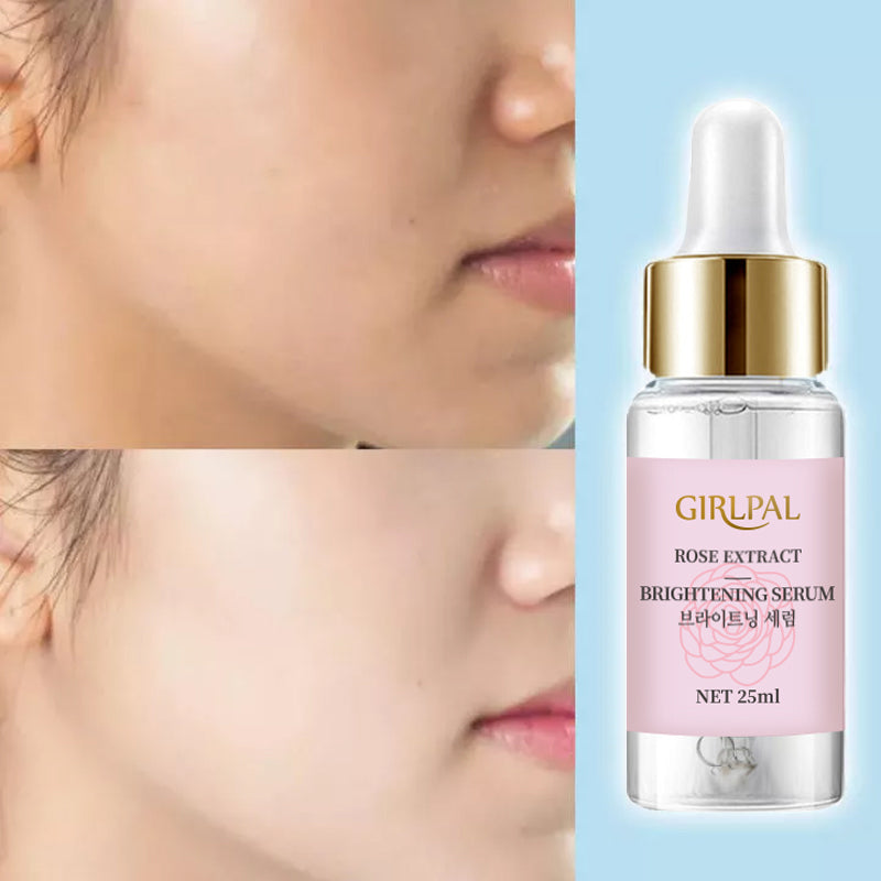 Girlpal Serum Niacinamide 4% Rose Brightening Essence | 25 ml